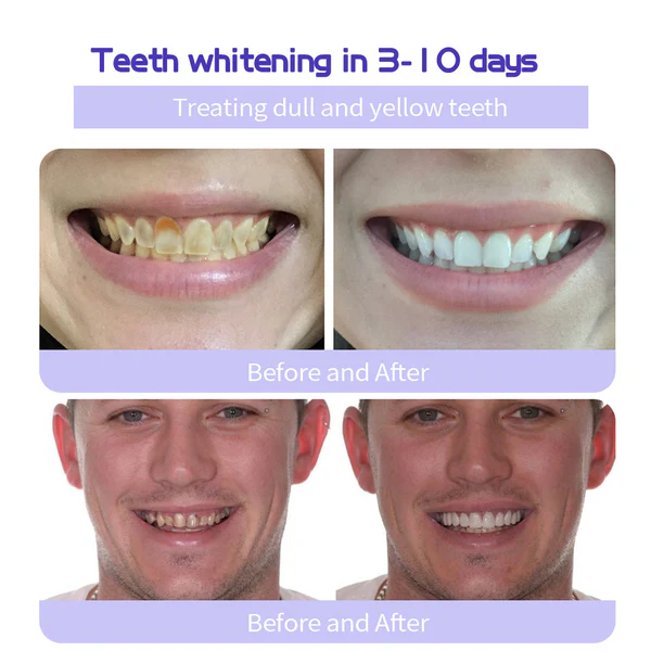 đ„Final 12 Hours: 60%OFFđ BBOJIâą Fluoride-Free Hydroxyapatite Toothpaste đ Your Smile, Naturally Brighter!
