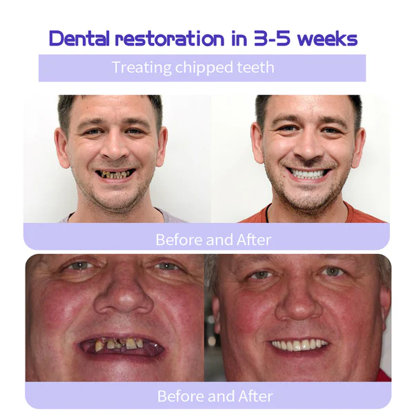 đ„Final 12 Hours: 60%OFFđ BBOJIâą Fluoride-Free Hydroxyapatite Toothpaste đ Your Smile, Naturally Brighter!