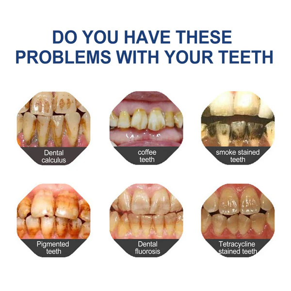 đ„Final 12 Hours: 60%OFFđ BBOJIâą Fluoride-Free Hydroxyapatite Toothpaste đ Your Smile, Naturally Brighter!
