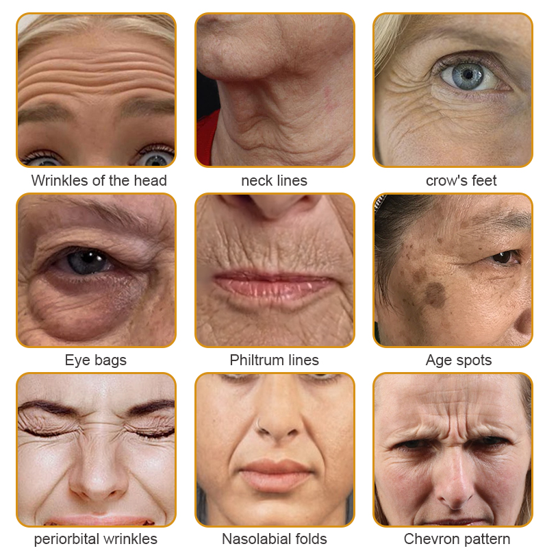 đ¨ââď¸đMade and Shipped from the USAâ
BBOJI⢠Botulinum Bienengift Wrinkle Removal Cream-Last Day Promotion 70% OFF