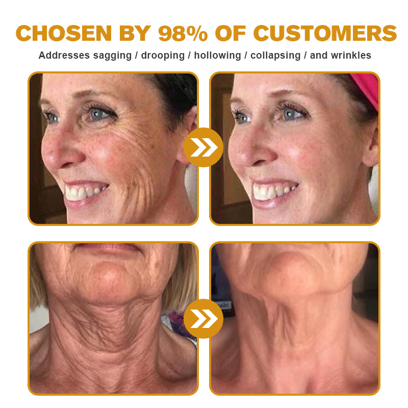 đ¨ââď¸đMade and Shipped from the USAâ
BBOJI⢠Botulinum Bienengift Wrinkle Removal Cream-Last Day Promotion 70% OFF