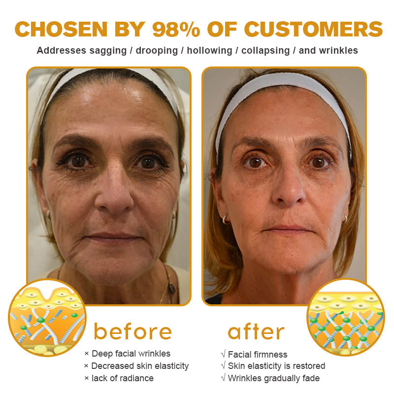 đ¨ââď¸đMade and Shipped from the USAâ
BBOJI⢠Botulinum Bienengift Wrinkle Removal Cream-Last Day Promotion 70% OFF