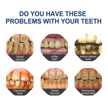 🔥Final 12 Hours: 60%OFF🎁 BBOJI™ Fluoride-Free Hydroxyapatite Toothpaste 💎 Your Smile, Naturally Brighter!